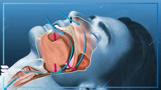 انقطاع التنفس أثناء النوم يسبب الخرف والنساء أكثر عرضة لذلك 